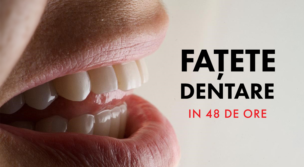 Fatete dentare in 48 de ore